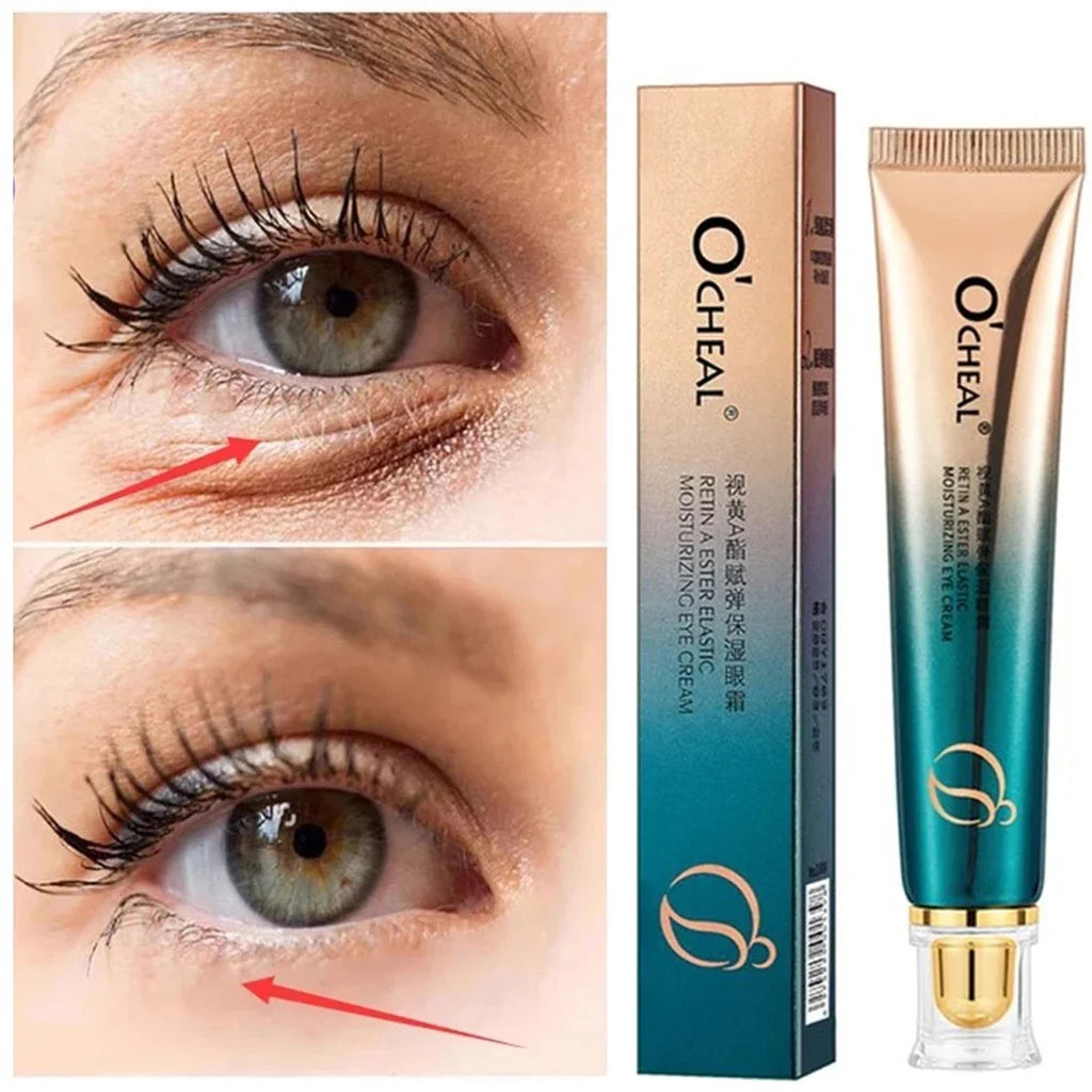 Lots OCHEAL Eye Moisturizing Cream Fades Fine Lines Anti Dark Circles Eye Serum Remove Eye Bag Puffiness Anti-Aging Eye Care