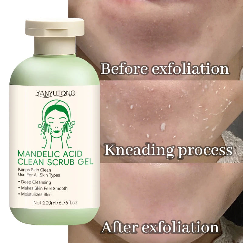 Facial Exfoliating Gel Deep Cleansing Pores Blackhead Removal Exfoliation Oil Control Moisturizing Scrub Improving Roughness