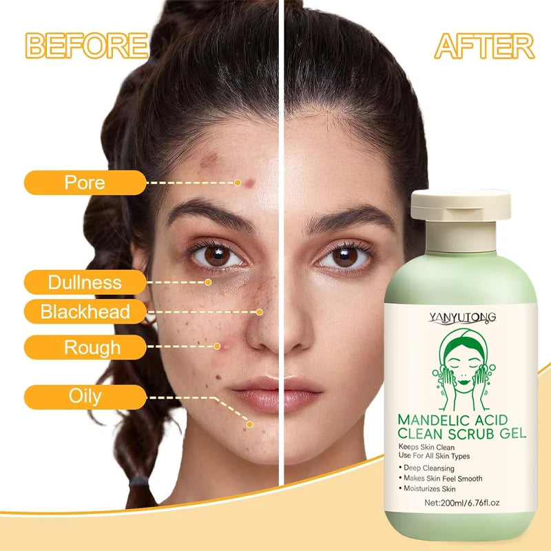 Facial Exfoliating Gel Deep Cleansing Pores Blackhead Removal Exfoliation Oil Control Moisturizing Scrub Improving Roughness
