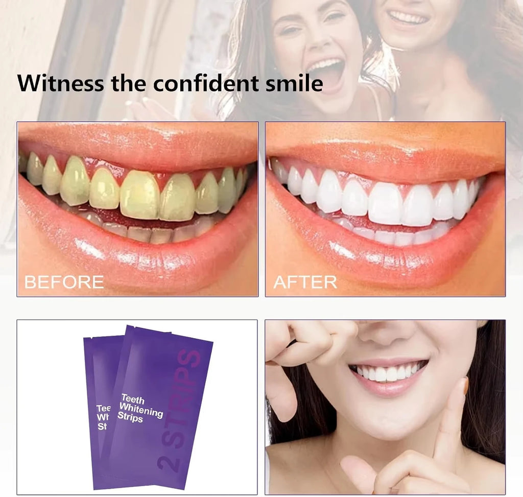 Premium Purple Whitening Strips, Deep Stain Cleaning, Perfect for Sensitive Teeth to Achieve Long-Lasting White Teeth